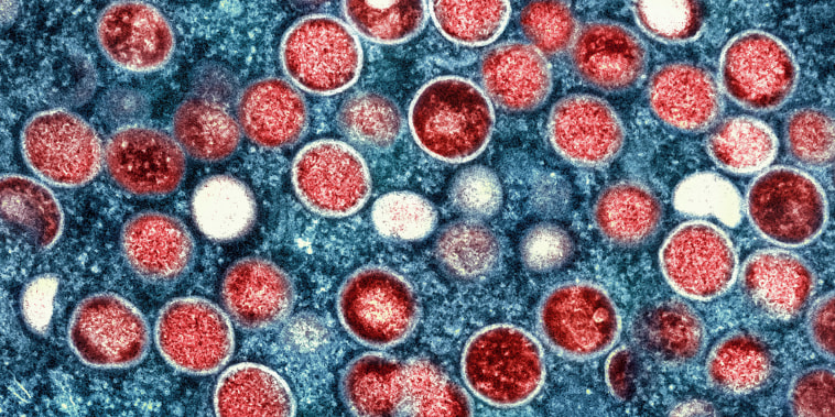 colorized transmission electron micrograph of monkeypox 