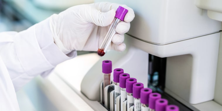 Close-up of a doctor hand looking at blood sample test tube in a machine. Cropped shot of unrecognizable scientist hands wearing protective gloves working in a testing laboratory.