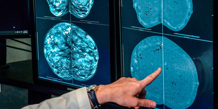 A doctor looks at mammogram imagery.
