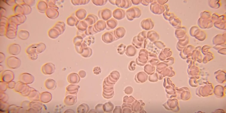 Autoridades detectan mosquitos infectados con el virus del Nilo Occidental en varios estados