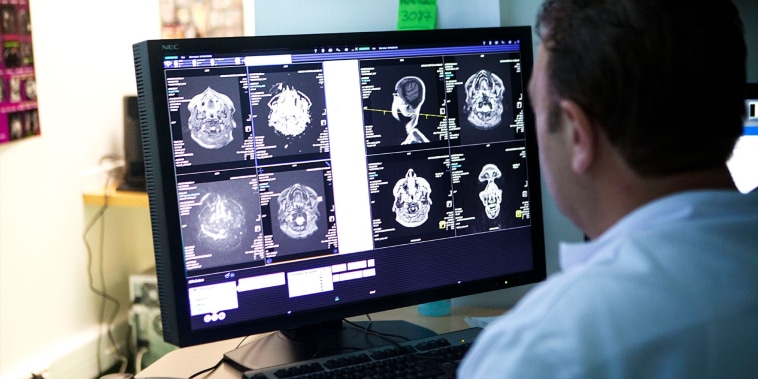 Hablar varios idiomas está vinculado a un cerebro más ágil