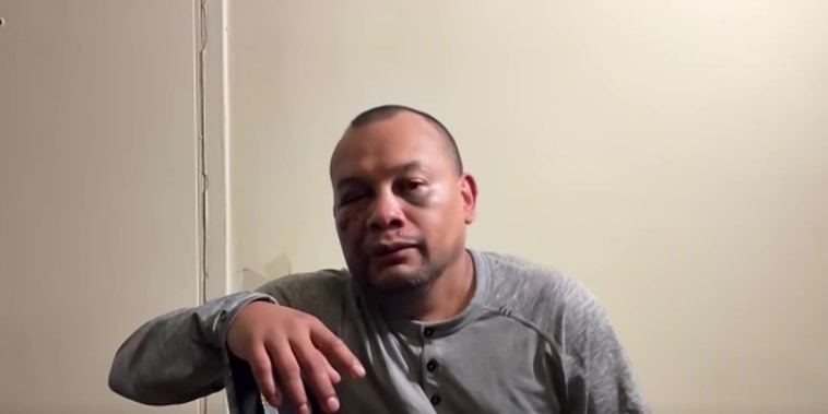 "Nunca pensé que iba a pasar por esto": inmigrante mexicano denuncia brutal agresión de ICE cuando iba a su trabajo