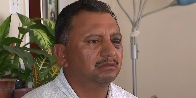 Un vendedor latino denuncia golpiza el 4 de julio en Long Beach
