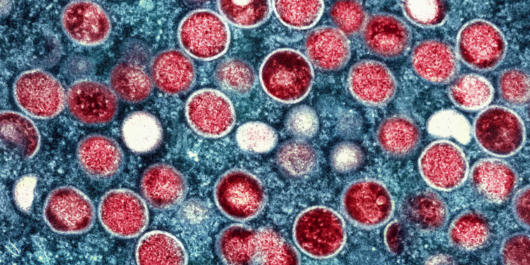 colorized transmission electron micrograph of monkeypox 