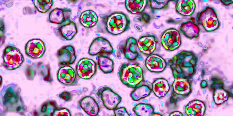 Measles Virus