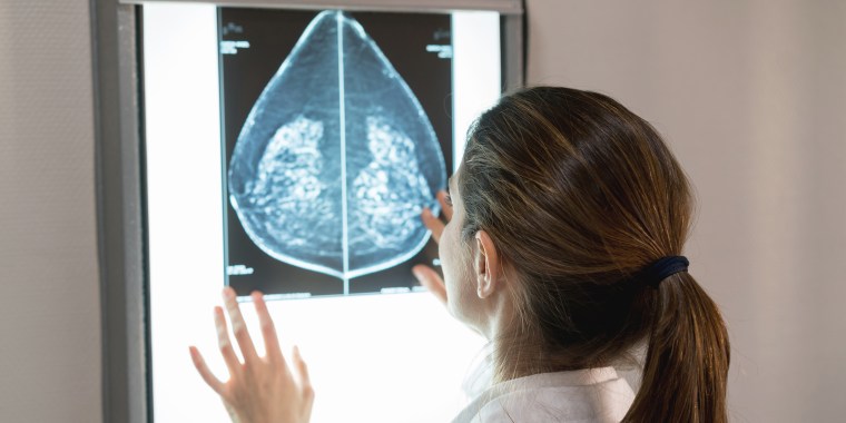 Unrecognizable female gynocologist looking at a mammogram at the hospital