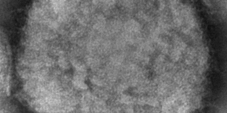 Esta imagen de microscopio electrónico de 2003, facilitada por los Centros para el Control y la Prevención de Enfermedades, muestra un virión de viruela del mono, obtenido de una muestra asociada al brote de perros de la pradera de 2003.