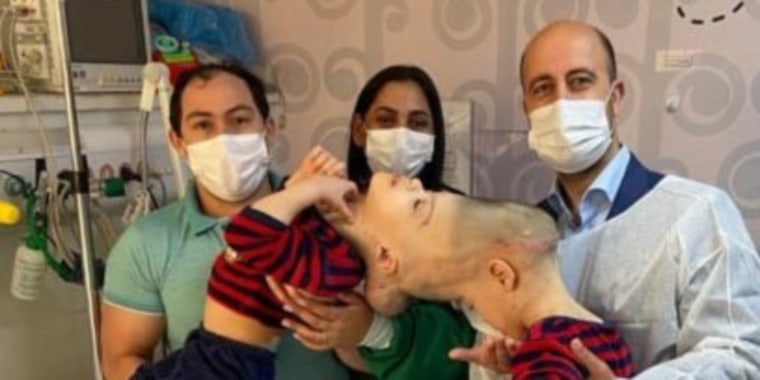 Los gemelos siameses Bernardo y Arthur Lima fueron separados con éxito durante una cirugía milagrosa en Brasil. Los niños aparecen en la foto difundida por la organización Gemini Untwined con sus padres y el cirujano Dr. Noor ul Owase Jeelani antes del procedimiento.
