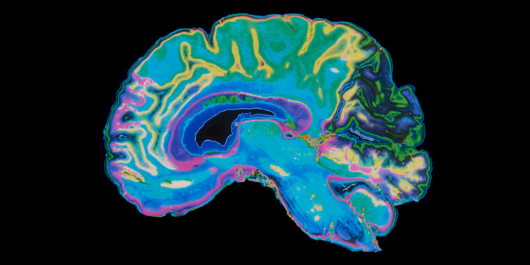 MRI Image Brain On Black Background