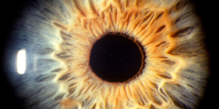 UNDATED PHOTO: A human eye is seen closeup, showing the iris and pupil in this undated photo.