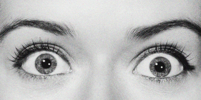 Image: Surprised eyes.