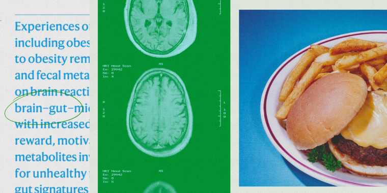Collage of brain scans and cheeseburger