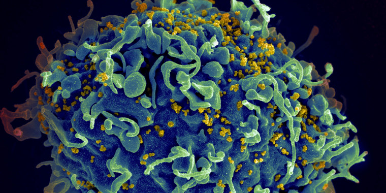 Imagen de microscopio electrónico facilitada por los Institutos Nacionales de Salud de EE.UU. donde se muestra una célula T humana, en azul, atacada por el VIH, en amarillo, el virus que causa el sida.