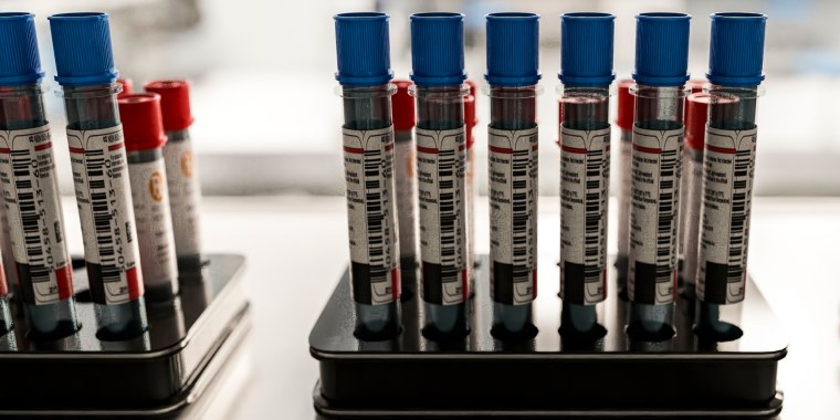 Blood samples in test tubes for medical diagnostics