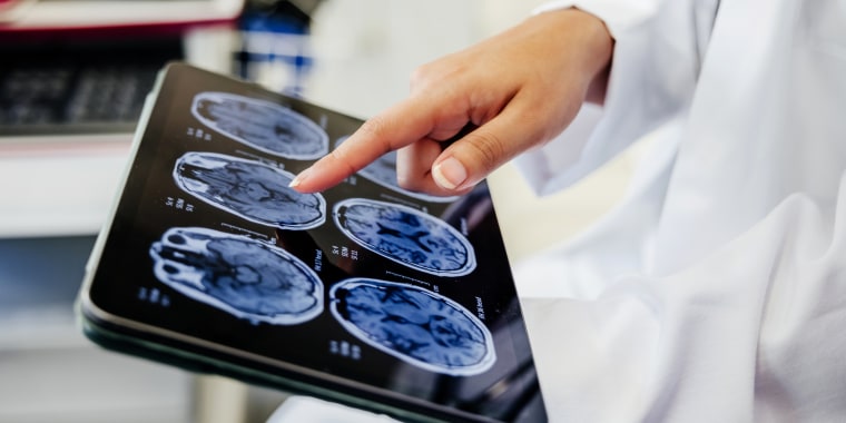 Estos 10 hábitos lo ayudan a proteger la salud de su cerebro