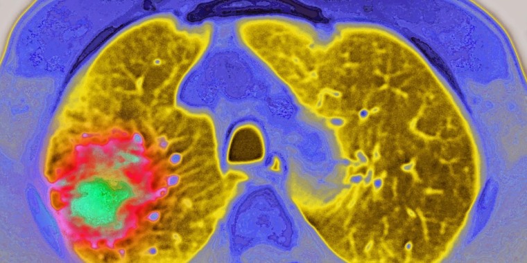 HeadlineImage