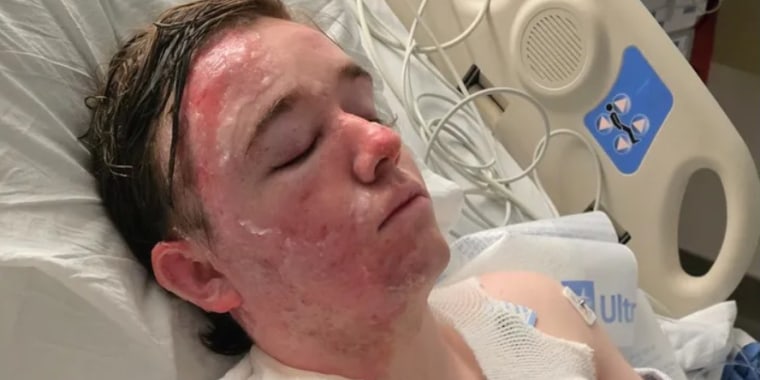 Acusan a empleado de McDonald’s de arrojar aceite a su compañero