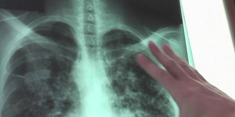 Cada vez más doctores están recurriendo a la inteligencia artificial