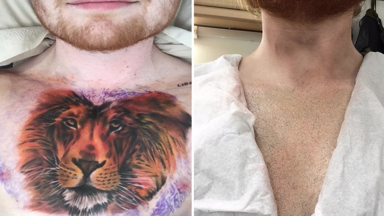 Why Did Ed Sheeran Have a Lion Tattooed on His Chest Video  Leo Sigh