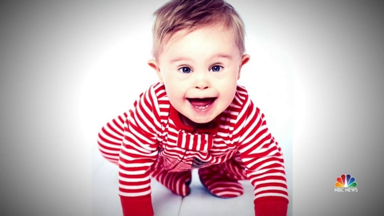 This Kid Is The Face of Change In Baby Modelling