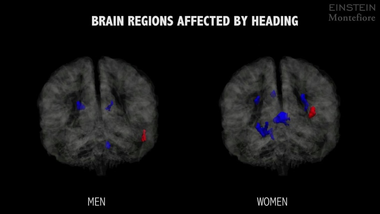 Heading a soccer ball: Female brain vs. male brain