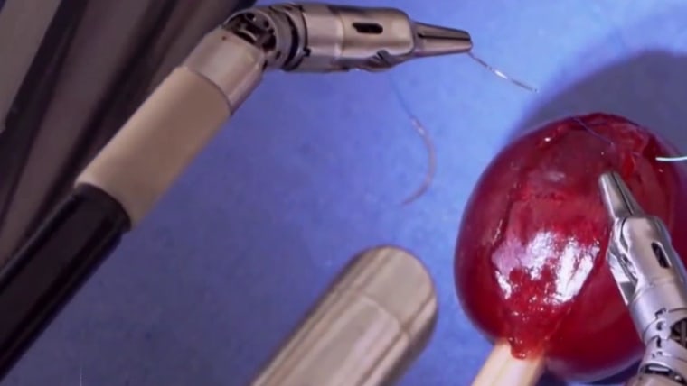 oase abort cache The da Vinci surgical robot: A medical breakthrough with risks for patients