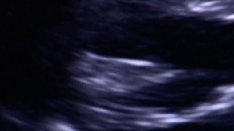 دولت جمهوري جورجيا. برايان كمپ ممنوعيت سقط جنين را امضا كرد