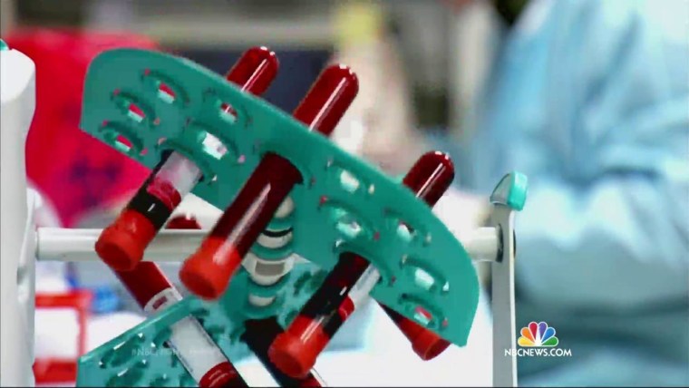 Blood Test May Detect Pancreatic Cancer in Early Stages