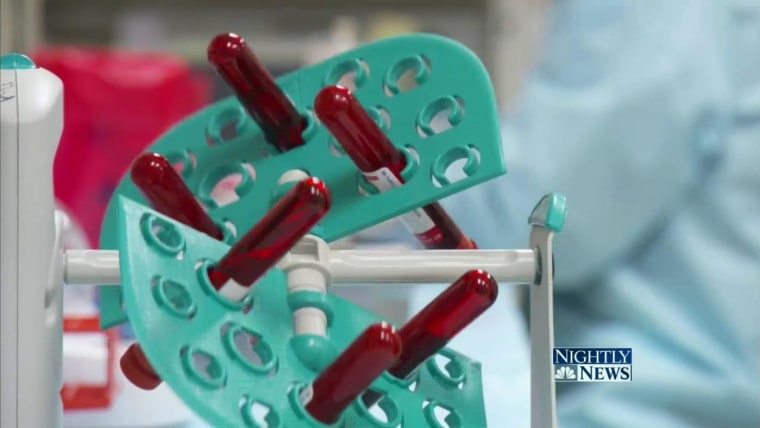 ‘Liquid Biopsy’ Blood Test Could Help Fight Lung Cancer: Study