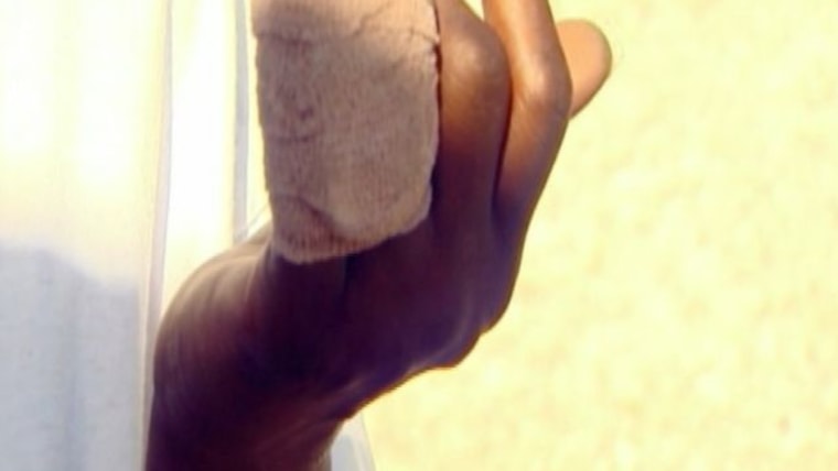 Woman loses finger after argument over cigarette