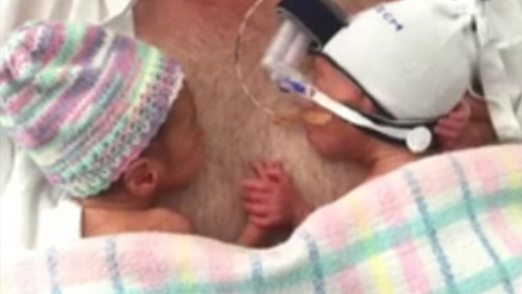 Preemies are Built of Stronger Stuff - Hand to Hold