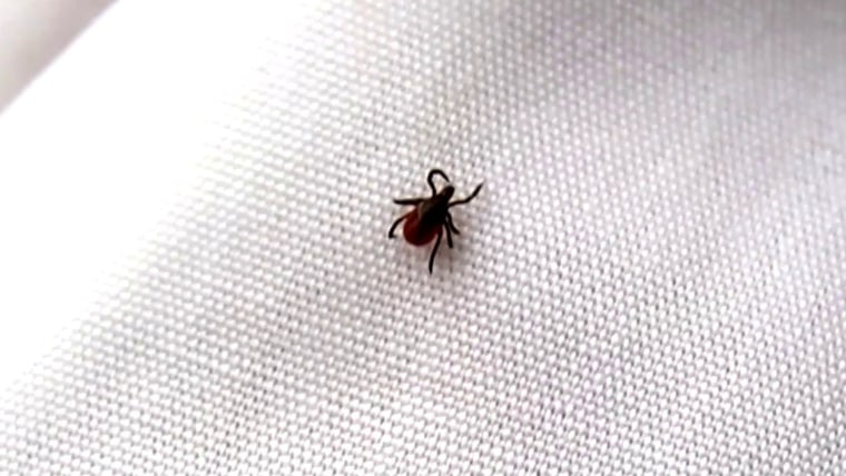 Tick removal: How to remove a tick the right way - TODAY