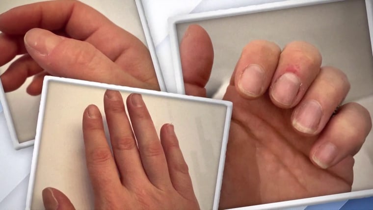 How to Stop Biting Your Nails | Kids Health Tips