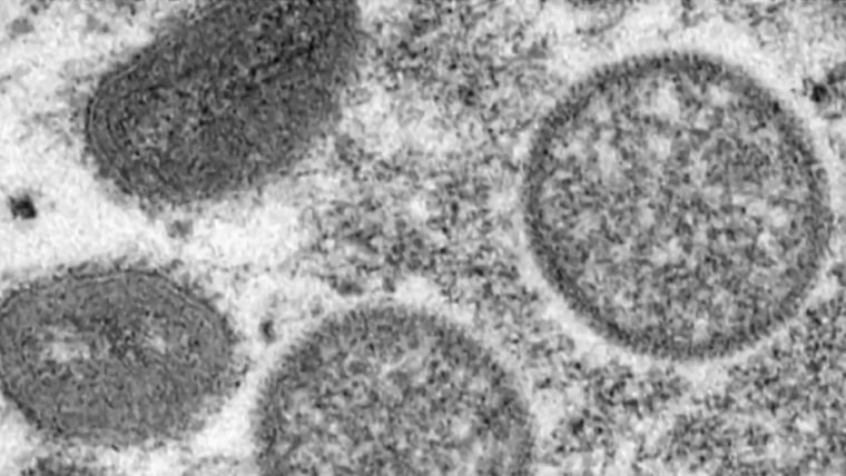 WHO declares monkeypox global public health emergency