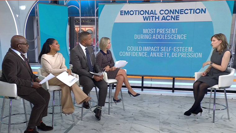 What to Know About Acne: Causes, Remedies, Prevention  www.today.com