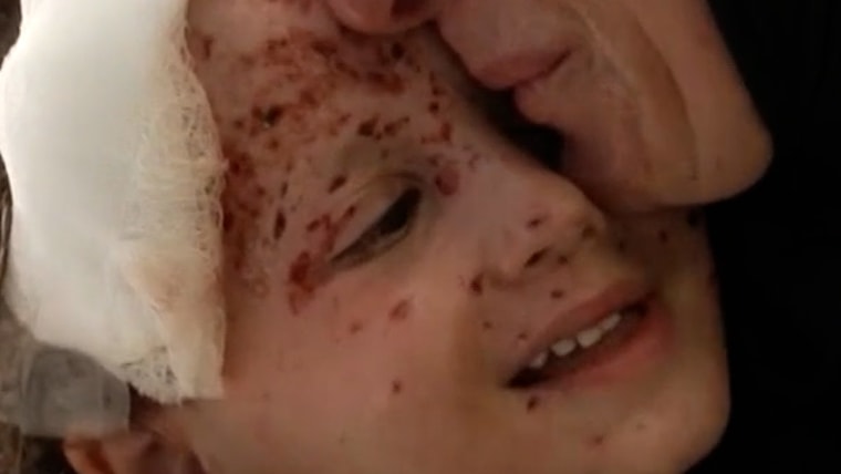 Inside a Beirut hospital treating wounded children