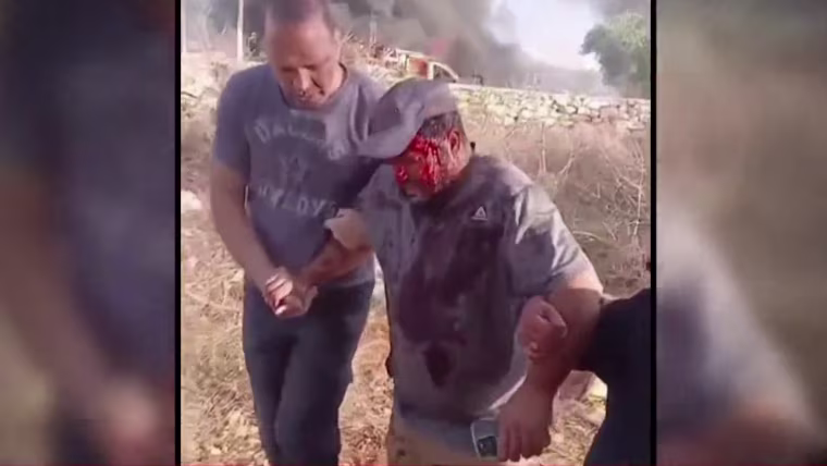Residenti israeliani hanno aggredito un giornalista americano in Cisgiordania