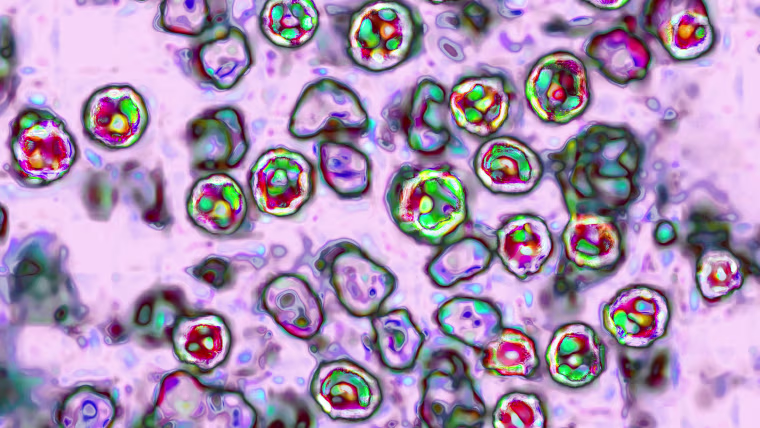 Measles Virus