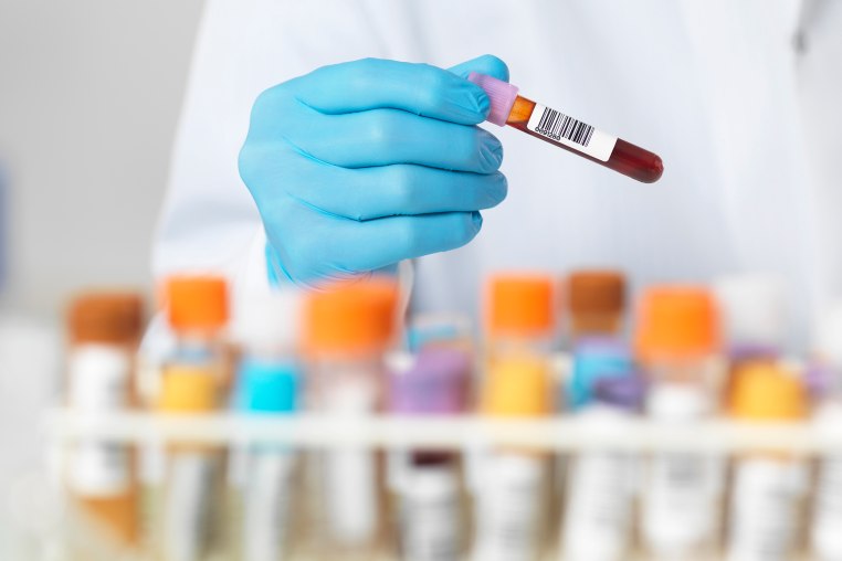 Close up of scientists hands selecting a blood sample for medical testing
