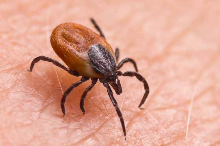 Infected female deer tick on hairy human skin.
