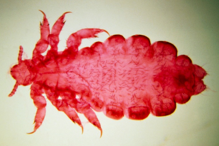 Light micrograph of female of human body louse