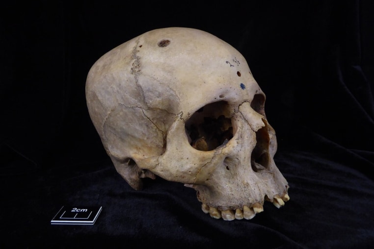 Skull and mandible