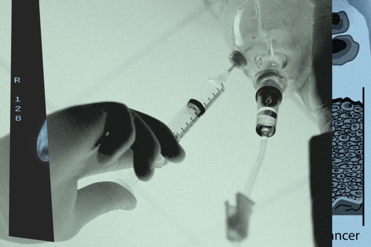 Photo illustration of an IV infusion 