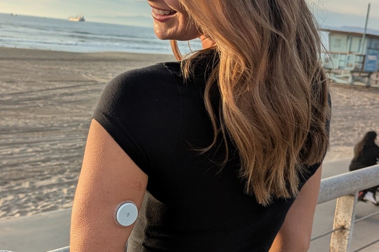 Shannon Sackley wearing a continuous glucose monitor.