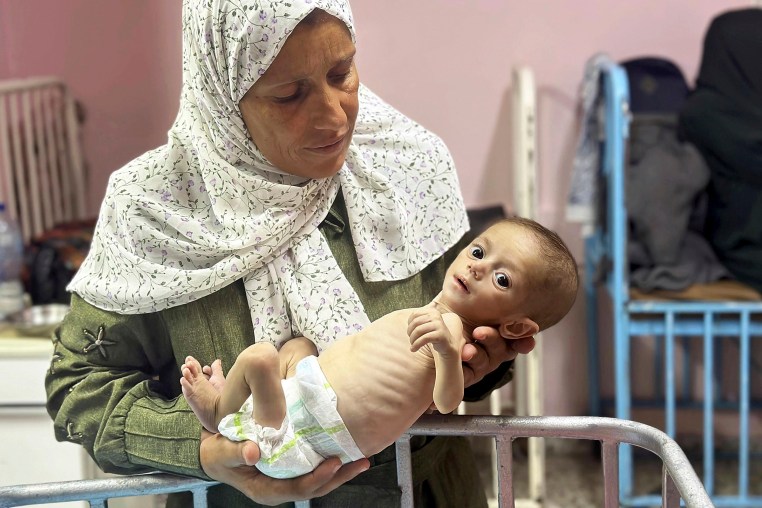A grandmother cradles a malnourished six-month-old baby