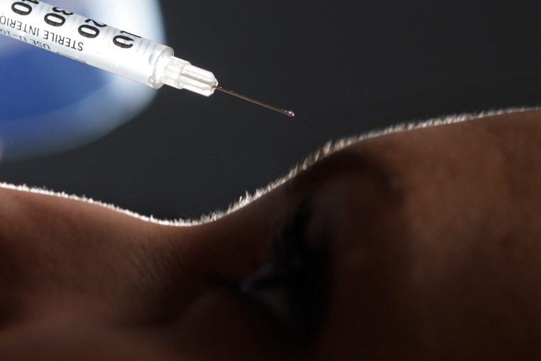 Botox injection
