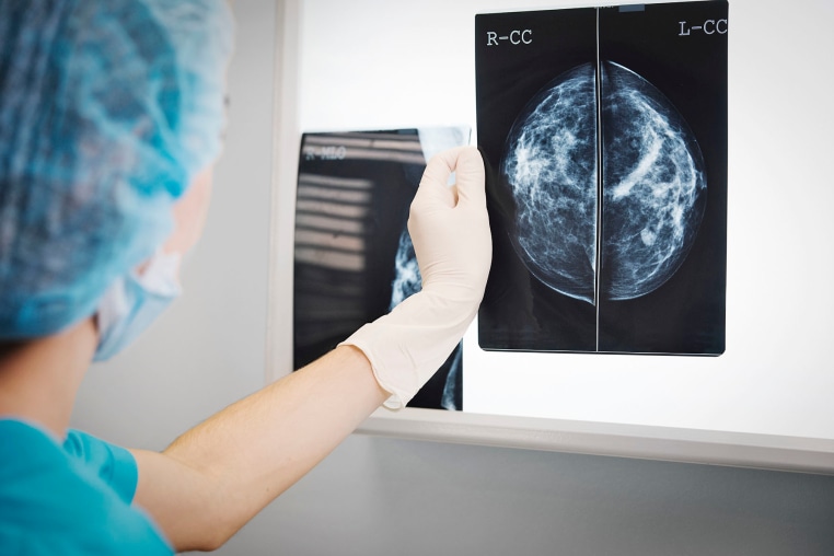 Doctor holding a mammogram in front of x-ray illuminator