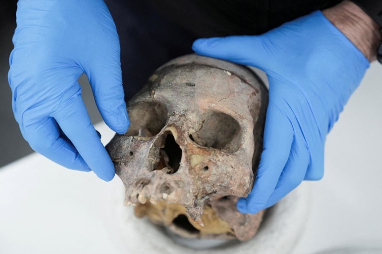 A human skull excavated in Colombia