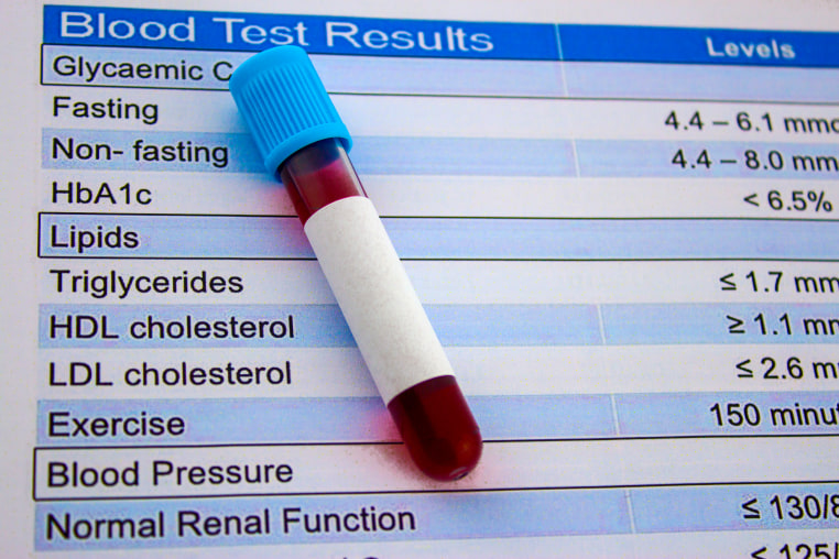 Cholesterol test and blood test tube
