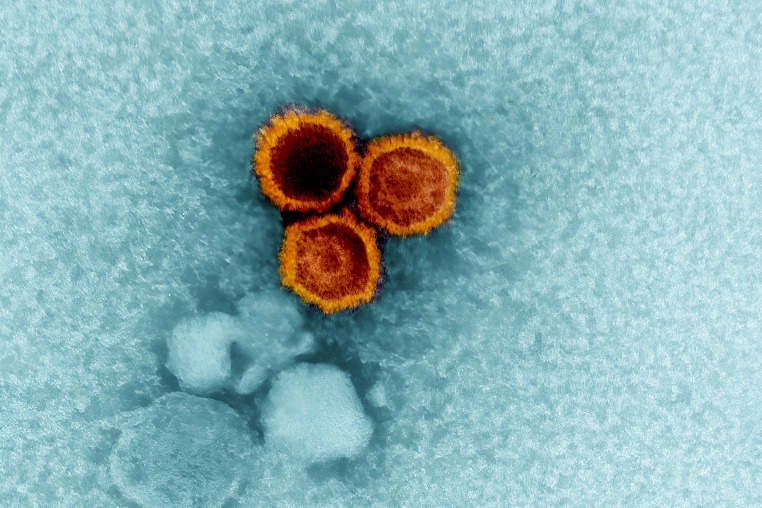 Epstein-barr virus particles